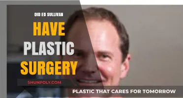 Ed Sullivan's Transformation: Plastic Surgery Rumors and Reality Revealed
