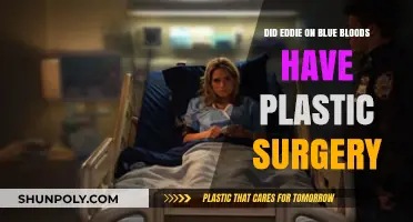 Eddie's Transformation: Plastic Surgery Rumors on Blue Bloods Explored