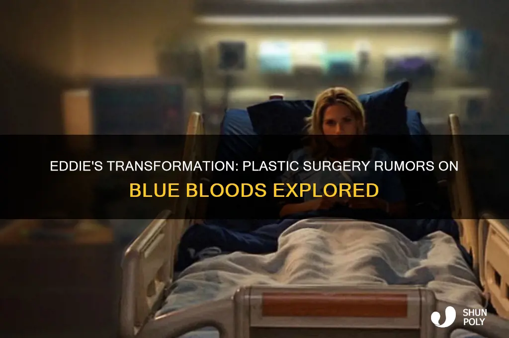 did eddie on blue bloods have plastic surgery