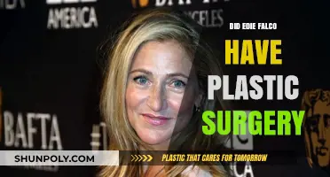 Edie Falco Plastic Surgery: Fact-Checking the Rumors and Speculations