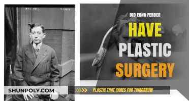 Edna Ferber's Appearance: Plastic Surgery Speculations and Truths