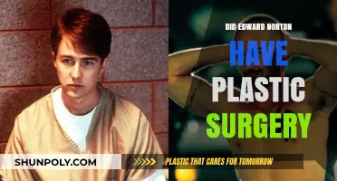 Edward Norton's Transformation: Plastic Surgery Rumors Explored and Debunked