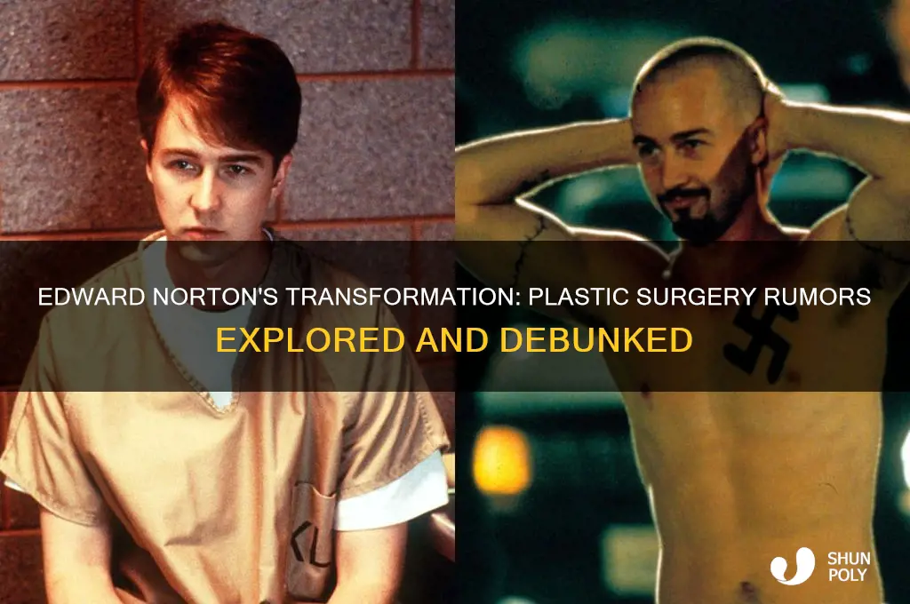 did edward norton have plastic surgery