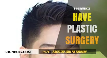 Edward Zo Plastic Surgery: Unraveling the Truth Behind the Rumors