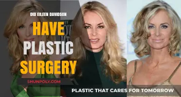 Eileen Davidson's Transformation: Plastic Surgery Speculations and Truths Revealed