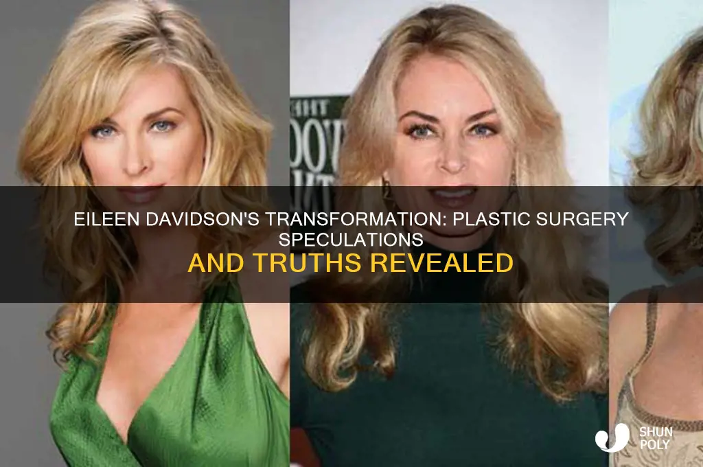 did eileen davidson have plastic surgery