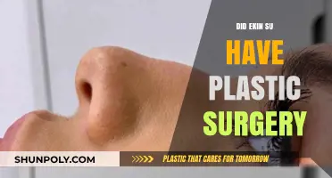 Ekin-Su's Transformation: Unveiling the Truth About Plastic Surgery Rumors
