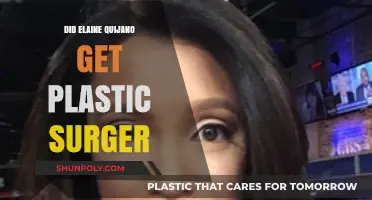 Elaine Quijano's Transformation: Plastic Surgery Speculations Explored