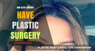 Elita Loresca Plastic Surgery: Fact-Checking the Rumors and Speculations