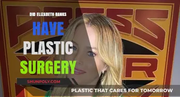Elizabeth Banks Plastic Surgery: Fact-Checking the Rumors and Speculations