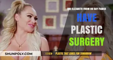 Elizabeth from 90 Day Fiancé: Plastic Surgery Transformation Explored