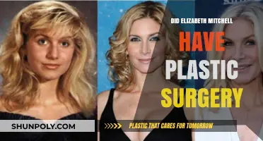 Elizabeth Mitchell's Transformation: Plastic Surgery Speculations and Truths