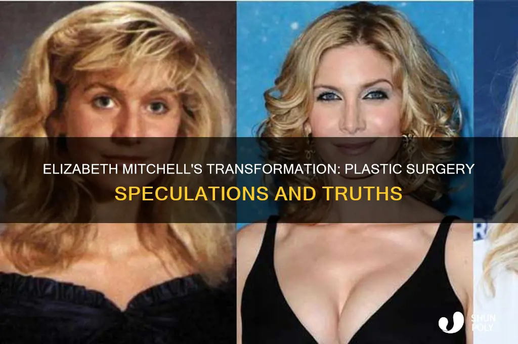 did elizabeth mitchell have plastic surgery