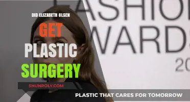 Elizabeth Olsen's Transformation: Plastic Surgery Rumors Explored and Debunked