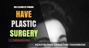 Elizabeth Perkins Plastic Surgery: Fact-Checking the Rumors and Speculations