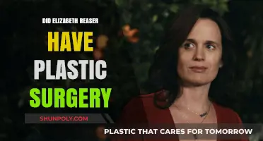 Elizabeth Reaser's Transformation: Plastic Surgery Speculations and Truths