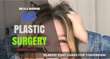 Ella Anderson Plastic Surgery: Fact-Checking the Rumors and Speculations