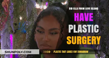 Ella's Transformation: Plastic Surgery Rumors After Love Island