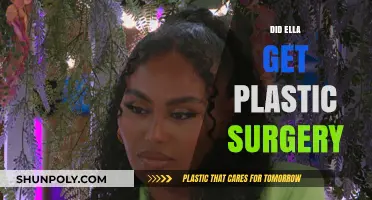 Ella's Transformation: Plastic Surgery Rumors and the Truth Behind Them