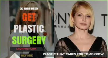 Ellen Barkin's Transformation: Plastic Surgery Rumors Explored and Debunked