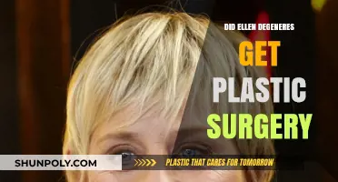 Ellen DeGeneres Plastic Surgery: Fact or Fiction? Unveiling the Truth