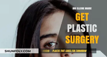 Ellerie Marie's Transformation: Plastic Surgery Rumors Explored and Debunked