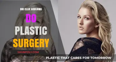 Ellie Goulding Plastic Surgery: Fact-Checking the Rumors and Speculations