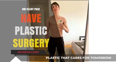 Elliot Page's Transformation: Plastic Surgery Speculations and Personal Journey