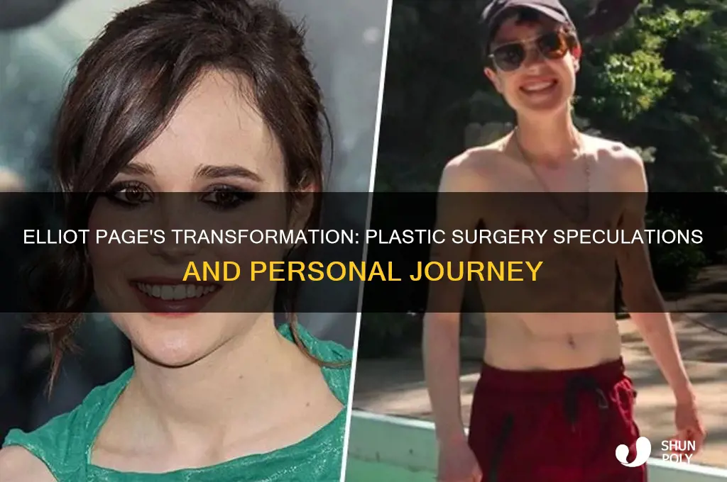 did elliot page have plastic surgery