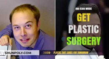 Elon Musk's Transformation: Plastic Surgery Speculations and Truths Revealed