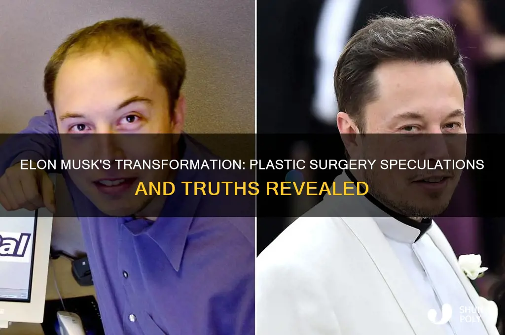 did elon musk get plastic surgery