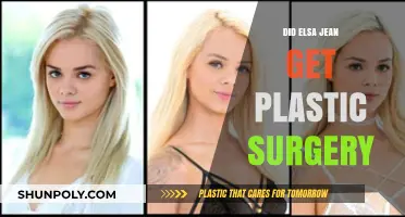 Elsa Jean Plastic Surgery: Fact-Checking the Rumors and Speculations