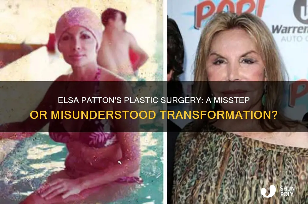 did elsa patton have bad plastic surgery