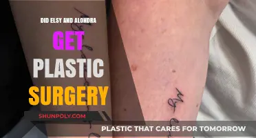 Elsy and Alondra's Transformation: Plastic Surgery Speculations Explored
