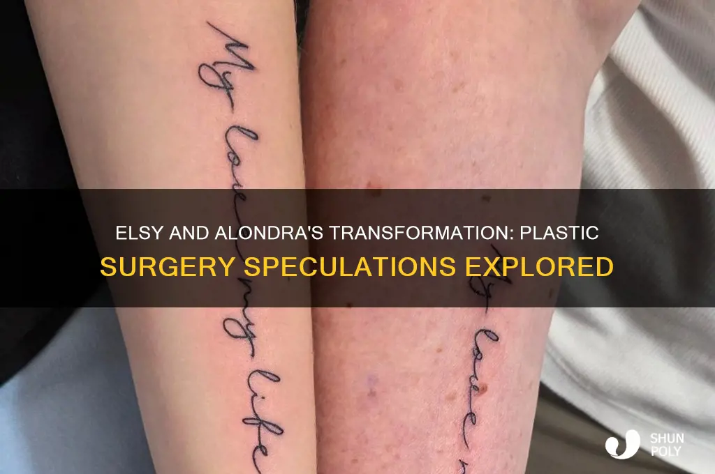 did elsy and alondra get plastic surgery
