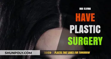 Elvira's Transformation: Unveiling the Truth About Her Plastic Surgery