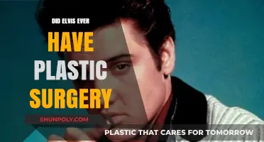 Elvis Presley's Plastic Surgery: Fact or Fiction?