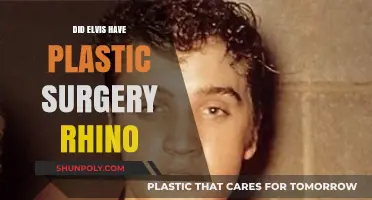 Elvis Presley's Rhinoplasty: Uncovering the Truth About His Plastic Surgery