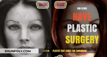 Elvis Presley's Plastic Surgery: Fact or Fiction? Uncovering the Truth