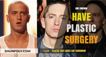 Eminem's Transformation: Plastic Surgery Rumors and the Truth Behind Them