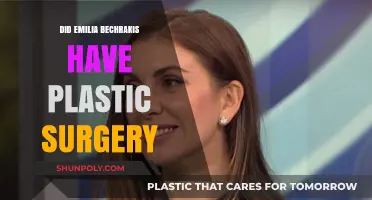 Emilia Bechrakis Plastic Surgery: Fact-Checking the Rumors and Speculations
