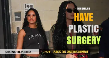Emily B's Transformation: Plastic Surgery Rumors and Speculations