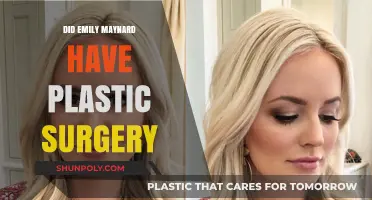 Emily Maynard's Transformation: Plastic Surgery Speculations and Truths Revealed