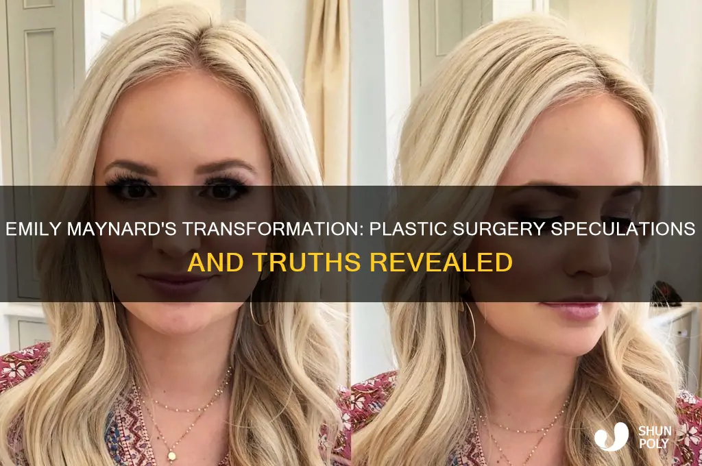 did emily maynard have plastic surgery