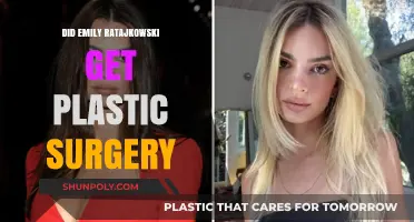 Emily Ratajkowski's Transformation: Plastic Surgery Rumors Explored