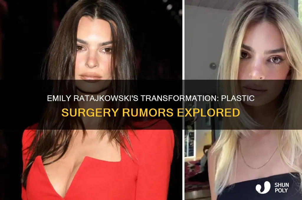 did emily ratajkowski get plastic surgery