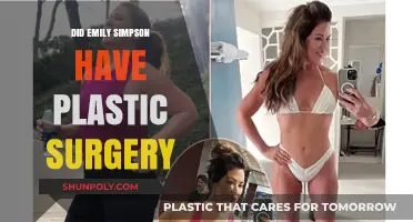 Emily Simpson's Transformation: Plastic Surgery Rumors Explored and Debunked