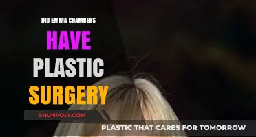 Emma Chambers Plastic Surgery: Fact-Checking the Rumors and Speculations