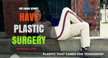 Emma Kenney Plastic Surgery: Fact-Checking the Transformation Rumors