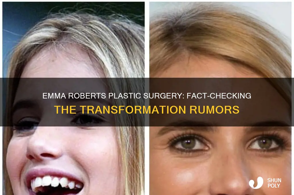 did emma roberts get plastic surgery